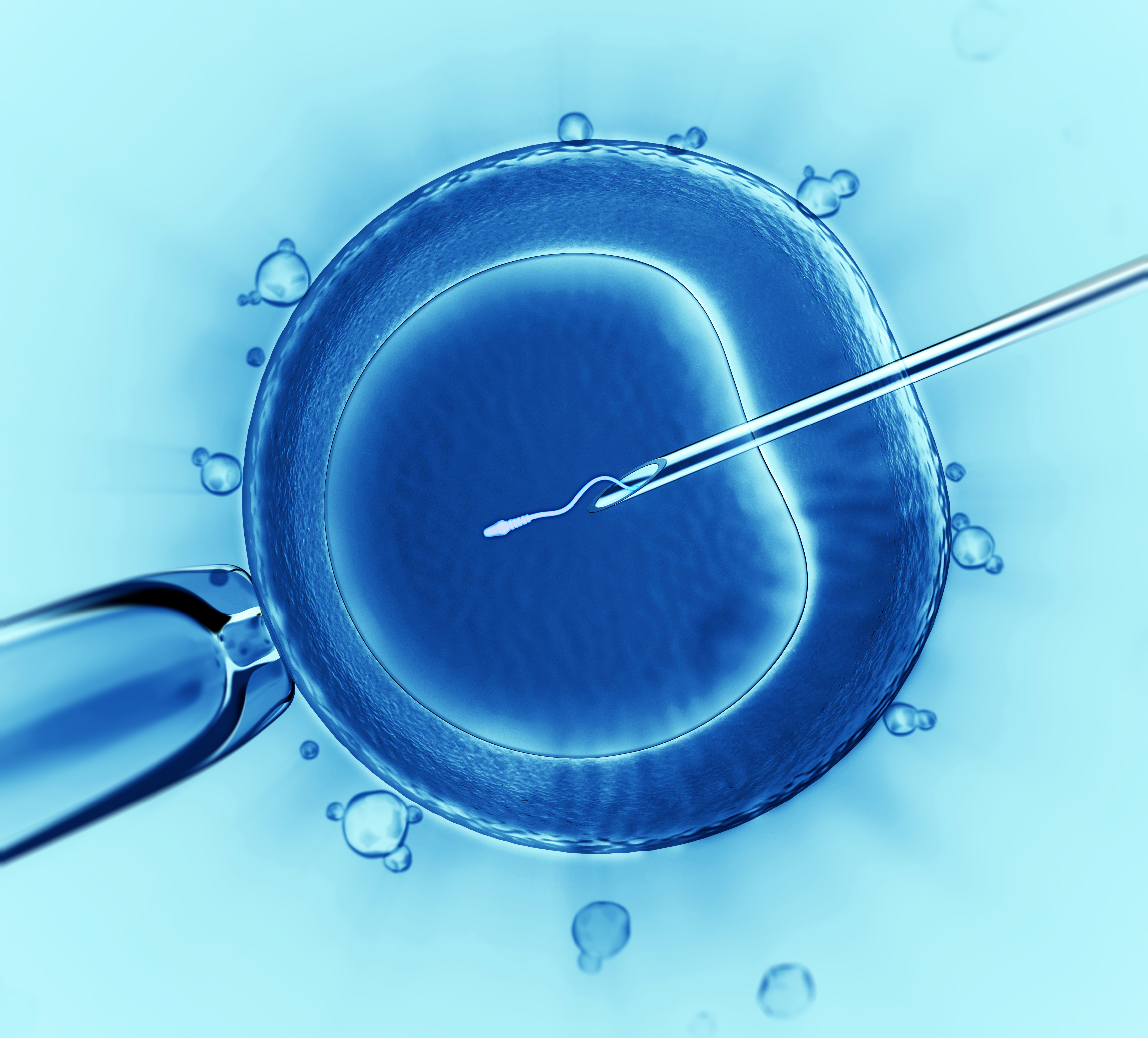 Sperm Injection IVF